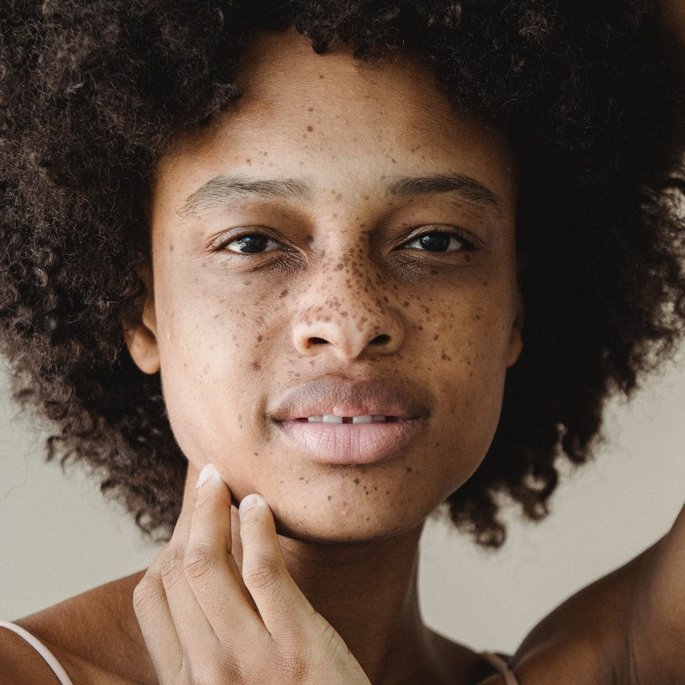 Sommersprossen & Fake Freckles